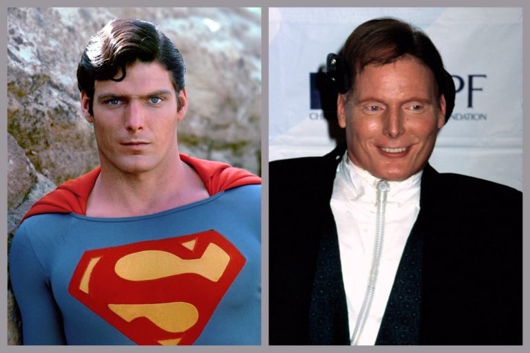 Christopher Reeve as Superman in 1978 alongside a post-1995 accident photo showing his ventilator and wheelchair